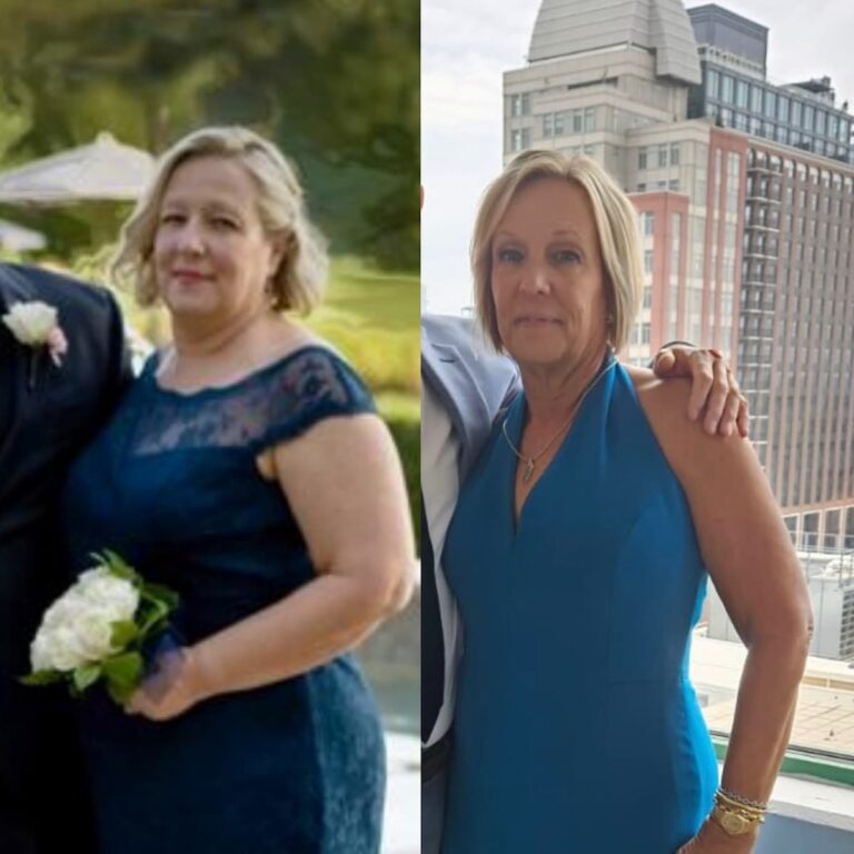 weight loss before and after picture of a woman in her 50s
