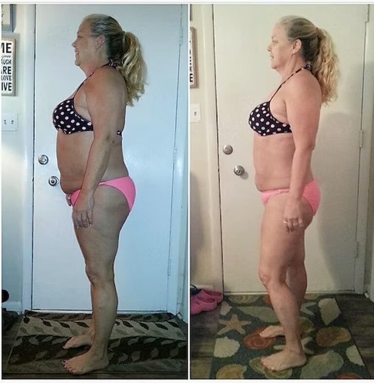 intermittent fasting weight loss results before and after picture