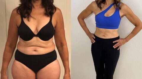 before and after weight loss results