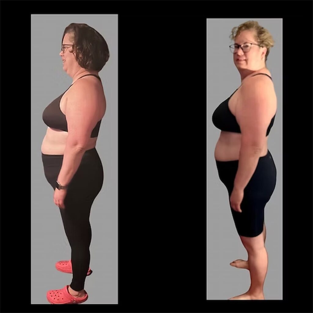 a woman's before and after weight loss results