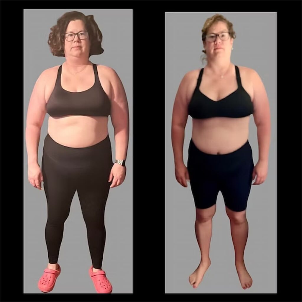 a woman's before and after weight loss results