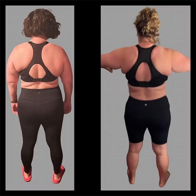 a woman's before and after weight loss results