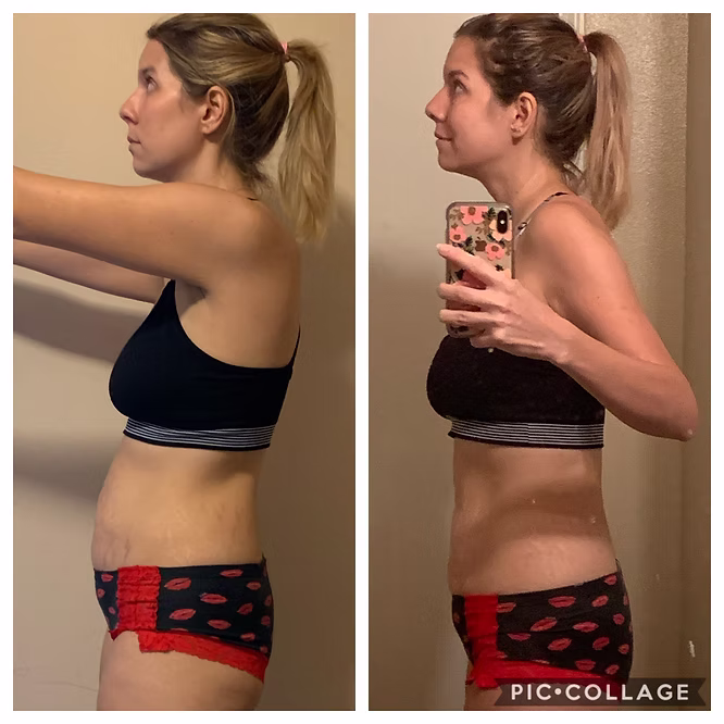 ashley de bloat before and after