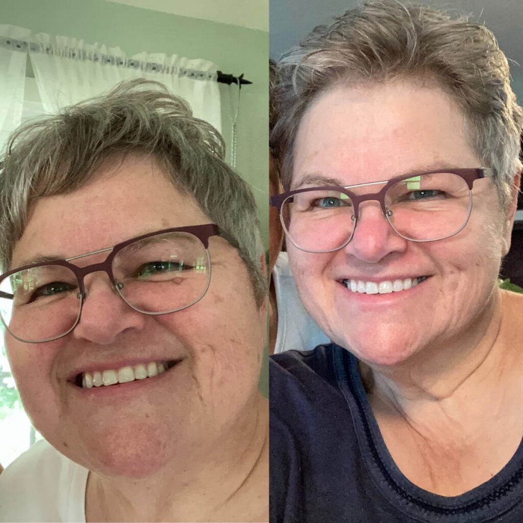 guylaine intermittent fasting weight loss result