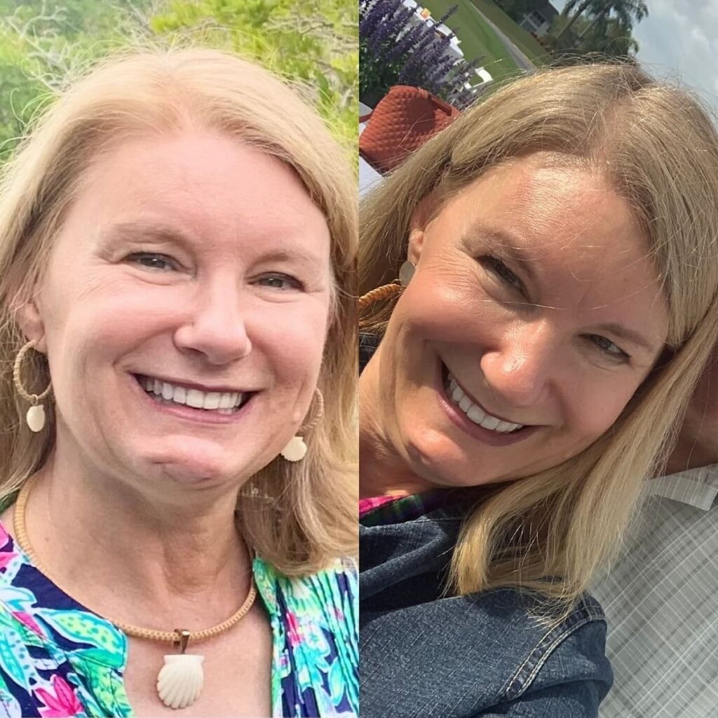 laura before and after