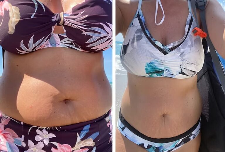 shellys intermittent fasting weight loss results