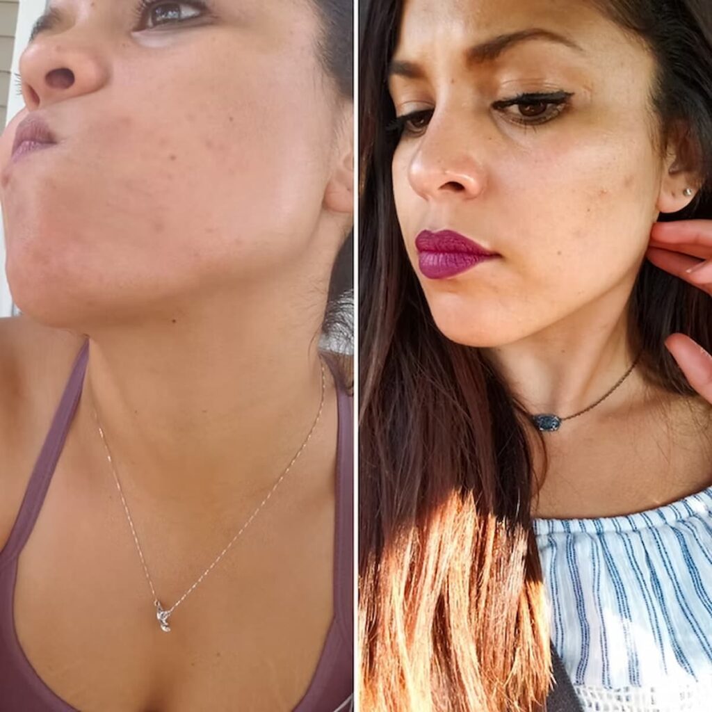 intermittent fasting skin results