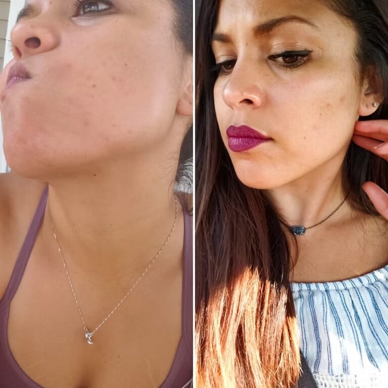 intermittent fasting skin results
