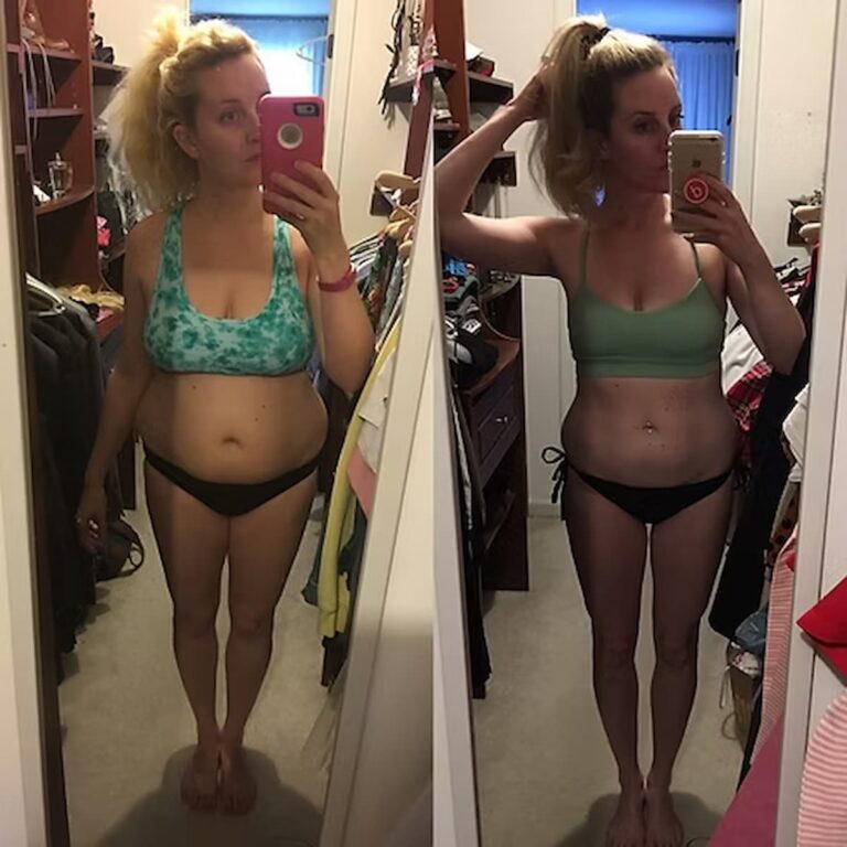 woman's before and after weight loss results